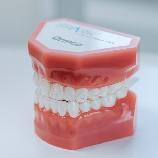 Orthodontie - onzichtbare beugel - tandartspraktijk de Waard Terheijden - Breda